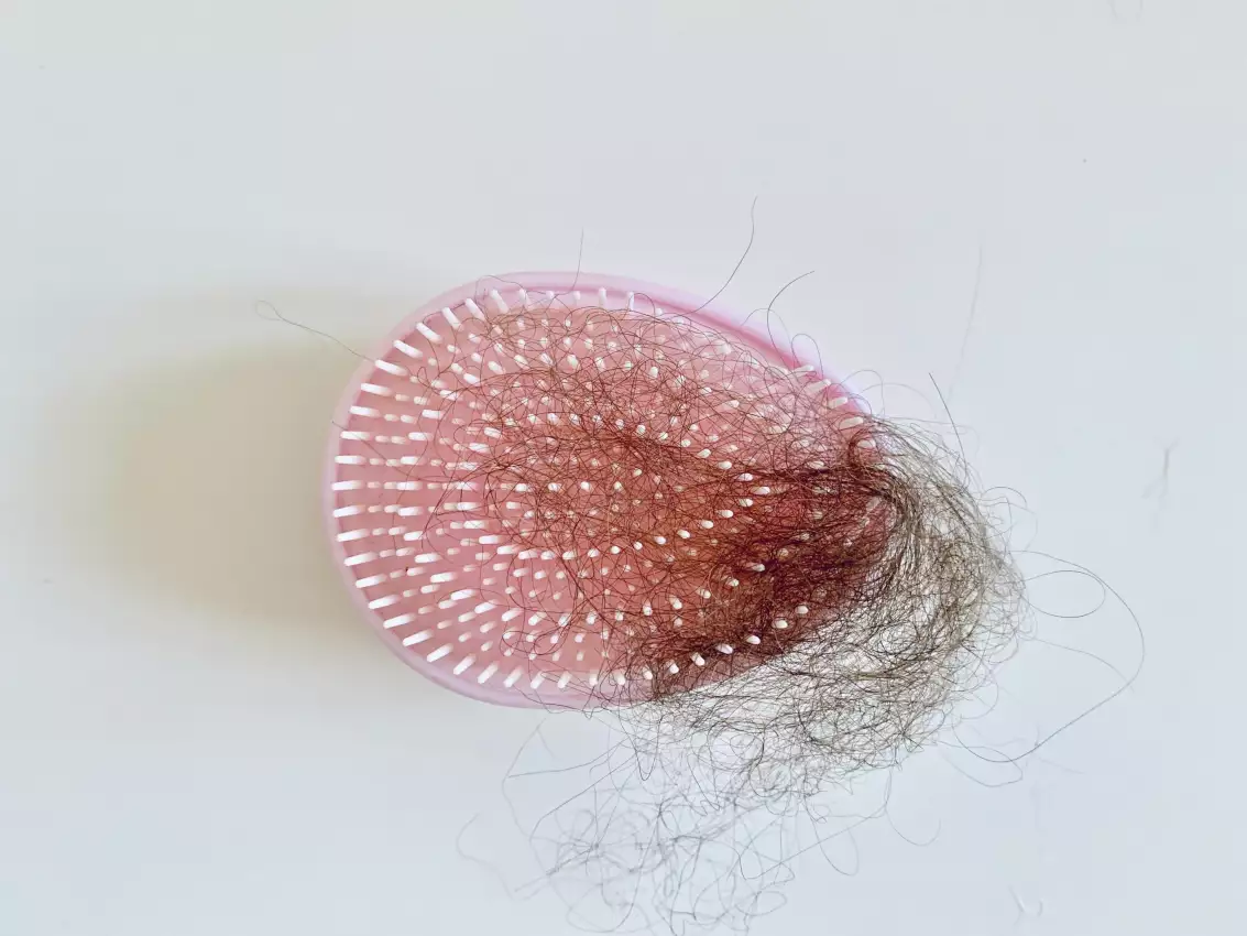 Haarausfall im Wochenbett